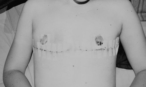 SMITH, Sub limis, 2010